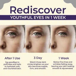 sanfe Brighten & Conceal Undereye Cream image 4