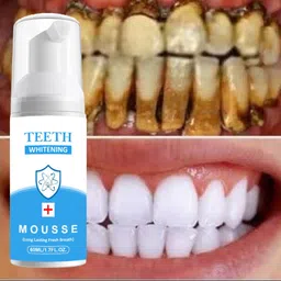 reglet Cool Mint Brilliance Refreshing Foam for a Brighter Smile Teeth Whitening Kit-picture-13