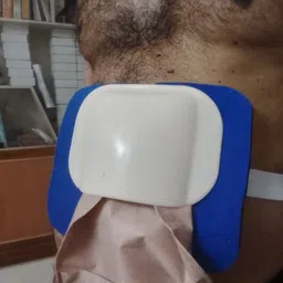 flovein STOMA GUARD FOR COLOSTOMY Bandage Protector image 2