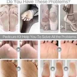 lowprice Foot File Set Dead Hard Skin Callus Remover Scraper Pedicure Rasp Tools Portable Cuticle Pusher Nail Foot Care Tool image 3