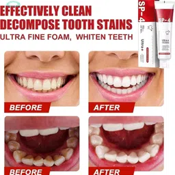avanure SP-4 Ultra Whitening Toothpaste Refreshing Gel Toothpaste image 4