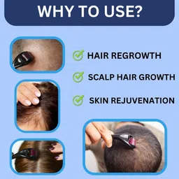 Blushing Babeue Home Use Derma Roller for Skin Firming and Collagen Boost image 4