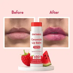 ontario Ceramide Vis Care Lip Balm with SPF50 PA+++ - Kojic Acid & Niacinamide Raspberry Natural image 2