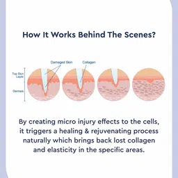 GUBB Pink Derma Roller For Skin Tightening & Rejuvenation image 5