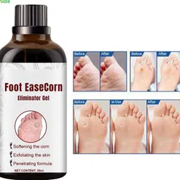 ayyiashi Corn Remover Serum 30ml Fast Results Pack Simple Easy Use-picture-13
