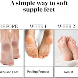 flytouch Foot Mask to Peel Dead Skin, Soften Hard Feet and Heal Cracked Heel Effectively image 4
