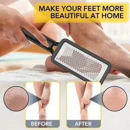vidhmahi Foot Callus Remover Tool Stainless Steel, Foot Filer image 2