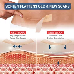 bhavrutt silicone scar removal sheet for C-Section, Acne Scars, Keloid and Surgical Scars Hydrocolloid Medical Dressing image 3