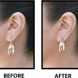 ablue clipper Disposable Ear Lobe Support image 2