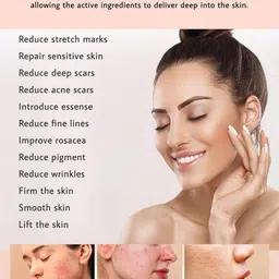 JM SELLER Derma Stamp Adjustable 0~3mm 100 Microneedles- for Hair, Beard growth, Skin care image 4