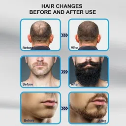 Effara Derma Stamp Kit With 140 Titanium Microneedles Boosts Beard and Hair Growth image 2