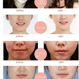 milixir Double Lifting Facial Mask | V Shaped Stretch, Wrinkle Reduce Face Slimming Tool Face Shaping Mask image 5