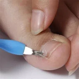 sunesa Pedicure Tools for Feet - 8 in 1 Pedicure Kit | Foot Scrubber for Dead Skin, Callus Remover, Foot Scraper, Foot File, Pitchfork, Filer for Nail Repair - 1 Set (100 g, Set of 8) image 5