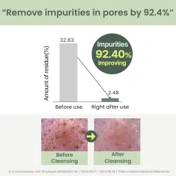 Heimish Matcha Biome Perfect Cleansing Oil | pH-Balanced (5.5) Hydrating Makeup Remover | Removes Waterproof Makeup & Impurities | Lightweight Non-Greasy Formula | All Skin Types, 150ml image 4