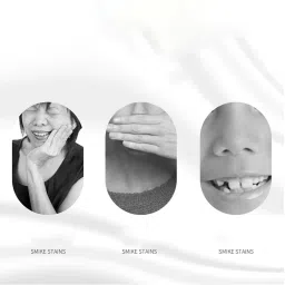 Bnf® Denture Bath Box Organizer with Strainer Basket Teeth Portable Light Blue|Health & Beauty | Oral Care | Denture Care image 4