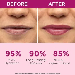 Orgatre Beetroot Lip Balm Tube with Ceramide, Kojic Acid & SPF 30 PA++ | Deep Moisturization & Pigmentation Care | Natural Beetroot Tint | Nourishes, Repairs & Protects Lips | 10ml - Pack of 2 image 1