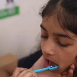 SPEECHGEARS TT-LR Tongue Lateralization and Elevation Tool (Cyan) Pack of 1 image 5