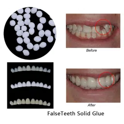 CALANDIS® Moldable Teeth Veneers with Adhesive Fitting Beads Temporary False Teeth | 1 bag Adhesive fitting beads | 3x fake teeth veneers image 1