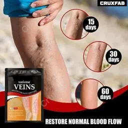 Varicose Veins Patches Dredge Vein Smoothing Varicose Veins Reduce Swelling Relieve Pain Instant Relief From Muscular Pain Improve Blood Circulation Skin Friendly (1) image 3