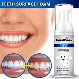 smartdrops Mint Teeth Whitening Mousse Foam for Deeply Cleaning Gums & Stain Removal Teeth Whitening Kit-picture-48