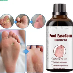 ayyiashi Foot Ease Corn Safe Formula 30ml Daily Pack For Smooth Feet-picture-34