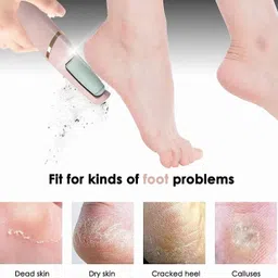 dhriyag Callus Remover for Feet | Foot Scrubber Kit for Silky Smooth Feet | Pedicure Kit image 4