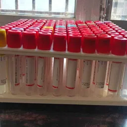 arcsol Test Tube Rack, 10 x 10 Array, 100 Wells, for up to 13 mm Tube Diameters Polypropylene Test Tube Rack image 2