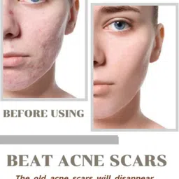 fezora Natural Niacid Face Serum - 10% Niacinamide,skin Brightening Serum, Anti-Aging image 2