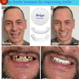 trinzzo smail covers Teeth Wipe image 1