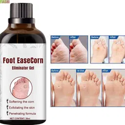 ayyiashi Feet Corn Remover Gel 30ml Safe To Use Smooth Feet Easy Application Formula-picture-20