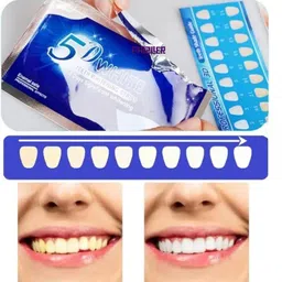 phizller Teeth Whitening Strips Premium Quality For Party Easy Apply Teeth Whitening Kit image 5