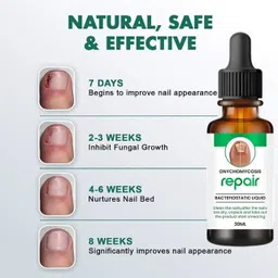 motyl Nail Repair Treatment Foot Removal Toe Infection Liquid for nails Clear-picture-16