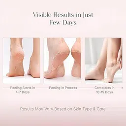 payalx Foot Peeling Mask for Dead Skin Removal image 4