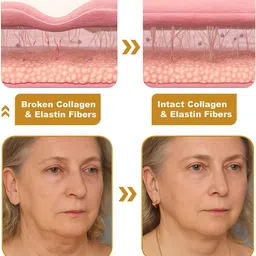 evicure BOTOX Wrinkle Removal Cream for Anti-Wrinkle&Glow for All Skin Types.PACK-3 image 4