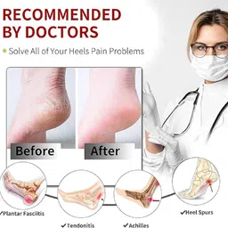 maune hub half silicone gel anti crack heel Heel Support image 5