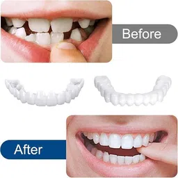 davalba Fake Teeth Temporary Denture Teeth Confidence Smile Dentures Veneers Fake White Teeth Wipe image 4