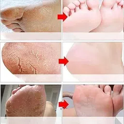 ruhaniq foot peeling mask For Dead Skin Remover Heel image 4