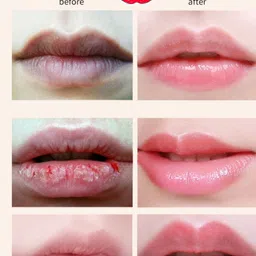 elibliss Strawberry Lip Serum for Lip Shine, Glossy,Soft with Moisturizer for Men & Women Strawberry image 3