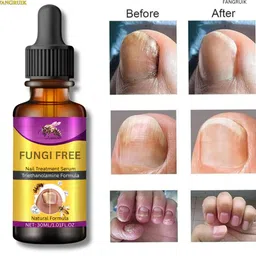 fangruik Nail Treatment Serum for Foot Nail Repair Care-picture-30