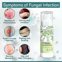 MOTYL Eczemaron Anti Fungal Cream for Immediate Itch Relief image 2