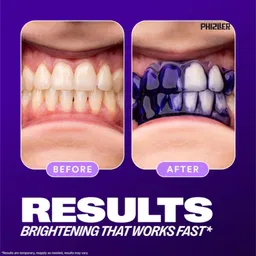 phizller hismile V34 Teeth Whitening Foam Corrector for Instant Whitening Look Teeth Whitening Liquid image 4