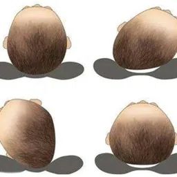 momease Polyester Fibre, Mustard Seeds Toons & Characters Baby Pillow Pack of 1 image 2