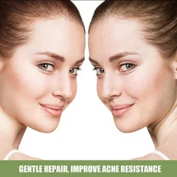 wonholli PP-1425 Ice Cream Mask Acne MoisturizingFace Shaping Mask image 5